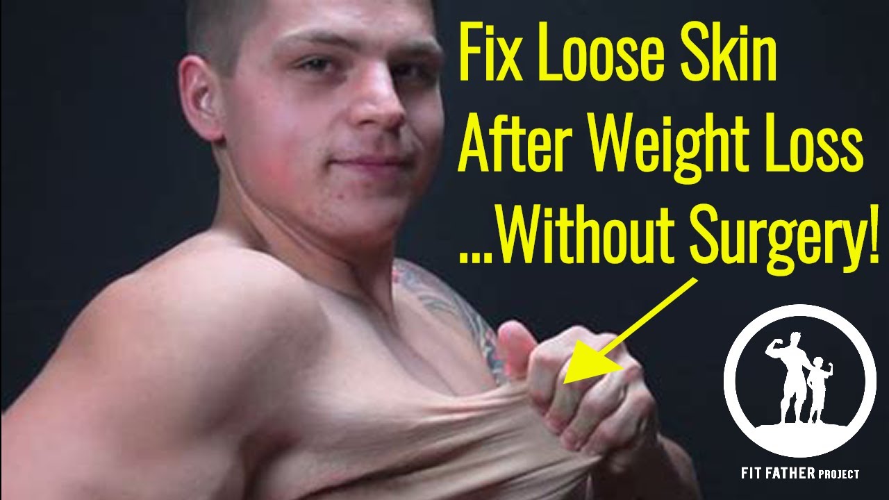 How To Fix Loose Skin After Weight Loss Men Without Surgery (5 Steps)